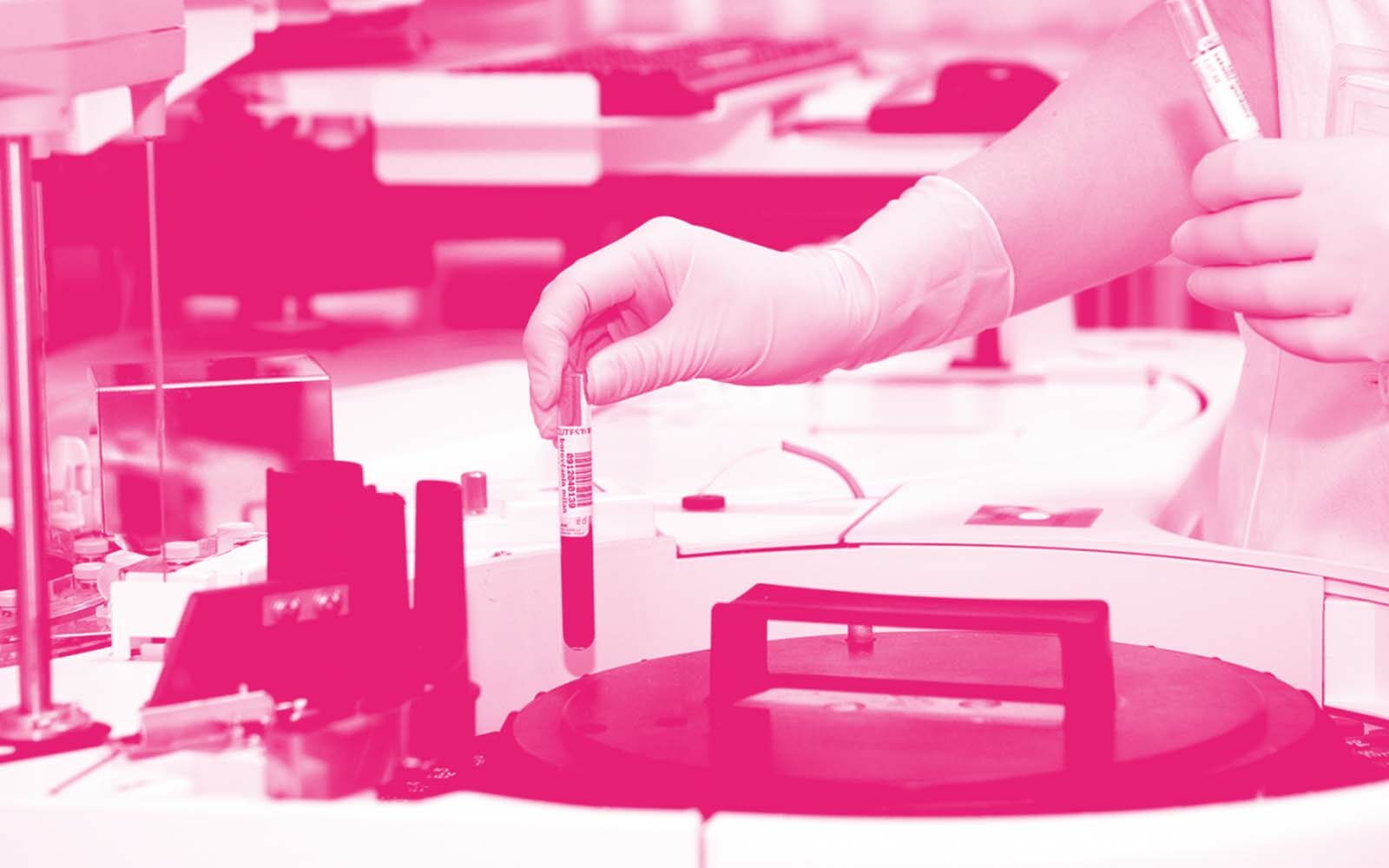 Blood sample being tested.